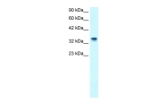 ARP34094_T100 - Nucleophosmin