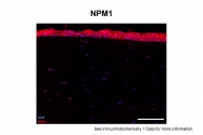 ARP34095_T100 - Nucleophosmin