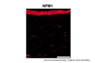 ARP34114_T100 - Nucleophosmin