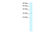ARP34114_T100 - Nucleophosmin