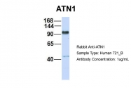 ARP34153_P050 - Atrophin-1