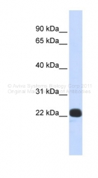 ARP34166_P050 - Recoverin