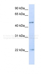 ARP34175_P050 - SS-A / Ro52 / TRIM21