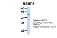 ARP34206_P050 - RBBP5 / RBQ3