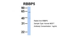 ARP34206_P050 - RBBP5 / RBQ3