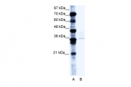 ARP34213_P050 - BMI-1 / RNF51