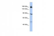 ARP34260_P050 - AFF2 / FMR2