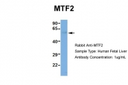 ARP34291_P050 - MTF2