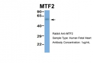 ARP34291_P050 - MTF2