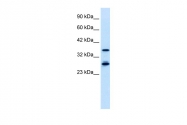 ARP34292_P050 - MTF2