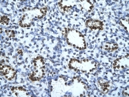 ARP34376_T100 - Alpha-enolase / ENO1