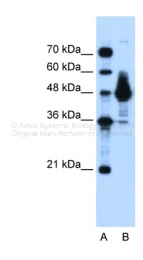 ARP34377_P050 - Alpha-enolase / ENO1