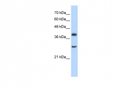 ARP34399_T100 - WDR39 / CIAO1