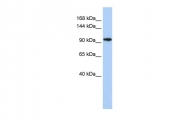 ARP34432_P050 - MRF / C11orf9