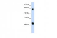 ARP34578_P050 - Kelch-like protein 26