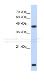 ARP34586_P050 - HDAC8