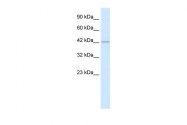 ARP34587_P050 - HDAC8