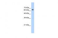 ARP34627_T100 - NACC2 / BTBD14A