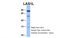 ARP34629_P050 - LAS1L