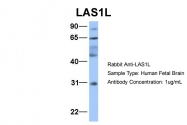 ARP34629_P050 - LAS1L