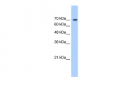 ARP34629_T100 - LAS1L
