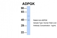 ARP34632_P050 - ADPGK