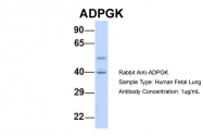 ARP34632_P050 - ADPGK