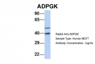 ARP34632_P050 - ADPGK