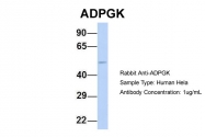 ARP34632_P050 - ADPGK