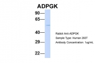 ARP34632_P050 - ADPGK