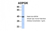 ARP34632_P050 - ADPGK