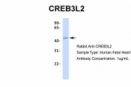 ARP34673_T100 - CREB3L2