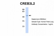 ARP34673_T100 - CREB3L2