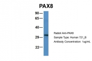 ARP34686_P050 - PAX5