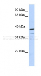 ARP34701_P050 - TRIM27 / RFP / RNF76