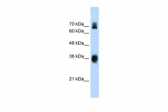 ARP34728_T100 - KEAP1