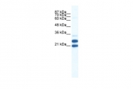 ARP34757_P050 - TRIM34 / RNF21