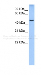 ARP34760_P050 - PHF17 / JADE1