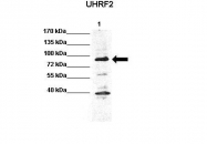 ARP34771_P050 - UHRF2