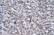 ARP34772_P050 - UHRF2