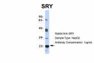 ARP34794_P050 - SRY / TDF