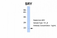 ARP34794_P050 - SRY / TDF