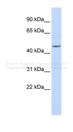 ARP34826_P050 - WDR45L / WIPI-3