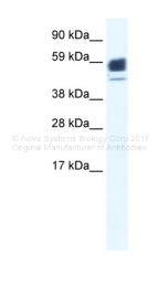 ARP34910_P050 - Acetylcholine receptor alpha subunit