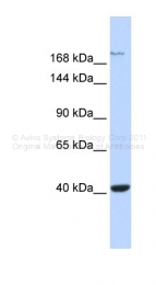 ARP35012_P050 - NMDA Receptor 2A