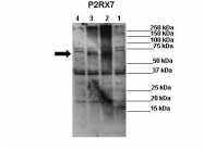 ARP35112_P050 - P2RX7 / P2X7