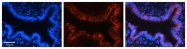 ARP35123_P050 - VDAC2