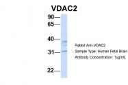 ARP35124_P050 - VDAC2