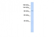 ARP35144_P050 - TRPC6 / TRP6