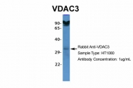 ARP35179_P050 - VDAC-3